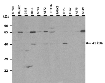 TRIB1 Rabbit Polyclonal Antibody