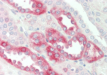 PDE1A Rabbit Polyclonal Antibody
