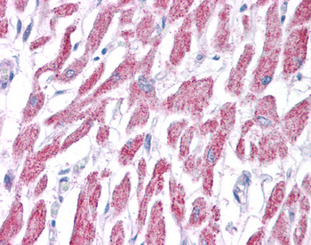 ACAT1 Rabbit Polyclonal Antibody