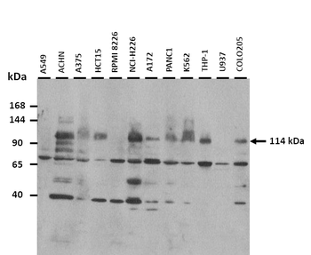 SYCP1 Rabbit Polyclonal Antibody