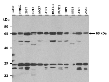 IGF2BP1 Rabbit Polyclonal Antibody