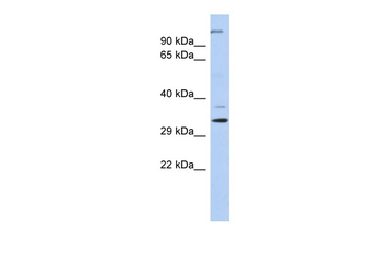 ARPC2 Rabbit Polyclonal Antibody