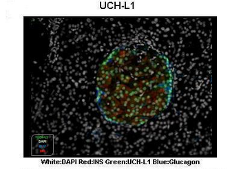 UCHL1 Rabbit Polyclonal Antibody