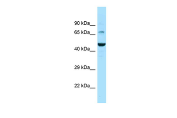 SLC6A11 Rabbit Polyclonal Antibody