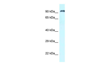 RASAL1 Rabbit Polyclonal Antibody