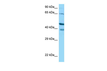CABP1 Rabbit Polyclonal Antibody