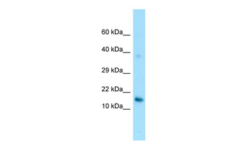 GPIHBP1 Rabbit Polyclonal Antibody