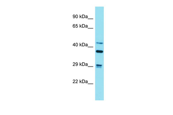 STRN Rabbit Polyclonal Antibody