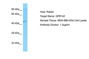 GPR142 Rabbit Polyclonal Antibody