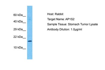AP1S2 Rabbit Polyclonal Antibody