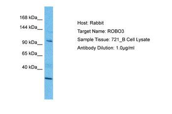 ROBO3 Rabbit Polyclonal Antibody