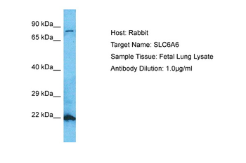 SLC6A6 Rabbit Polyclonal Antibody