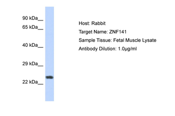 ZNF732 Rabbit Polyclonal Antibody