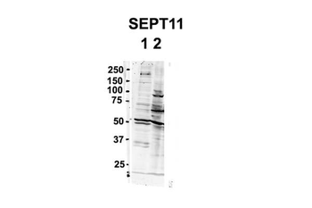 SEPT11 Rabbit Polyclonal Antibody