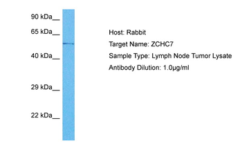 ZCCHC7 Rabbit Polyclonal Antibody