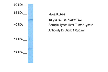 TRMT10A Rabbit Polyclonal Antibody
