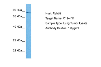 INTS13 Rabbit Polyclonal Antibody