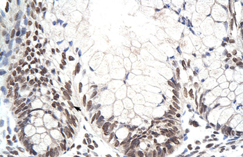 ZNF394 Rabbit Polyclonal Antibody