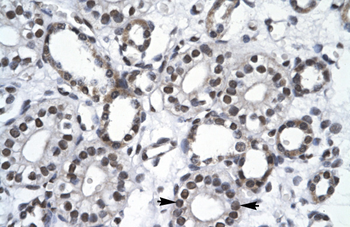 RBM10 Rabbit Polyclonal Antibody