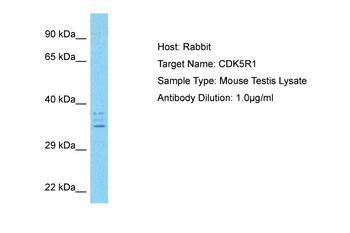 Cdk5r1 Rabbit Polyclonal Antibody
