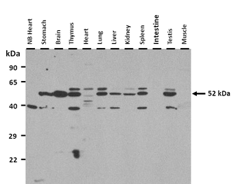 Gabra5 Rabbit Polyclonal Antibody