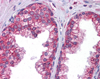 STAT6 Rabbit Polyclonal Antibody