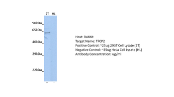 TFCP2 Rabbit Polyclonal Antibody