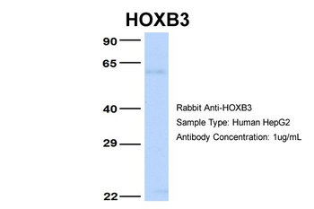 HOXB3 Rabbit Polyclonal Antibody