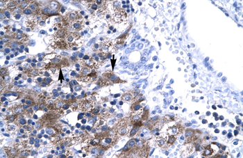 NFYA Rabbit Polyclonal Antibody