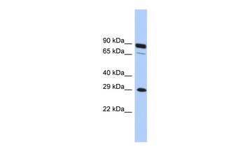 HOXC5 Rabbit Polyclonal Antibody