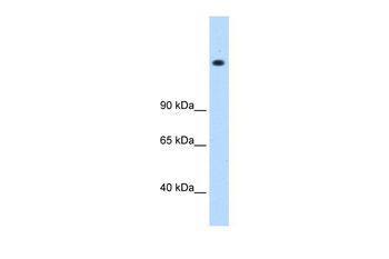 MED16 Rabbit Polyclonal Antibody
