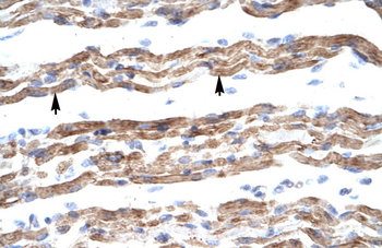 PQBP1 Rabbit Polyclonal Antibody