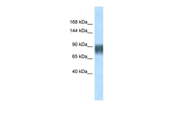 Avil Rabbit Polyclonal Antibody