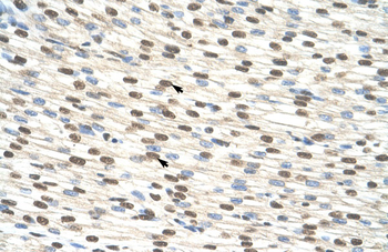 ZNF274 Rabbit Polyclonal Antibody
