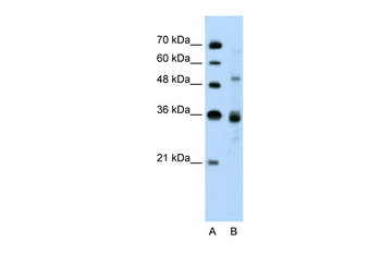 TNRC4 Rabbit Polyclonal Antibody
