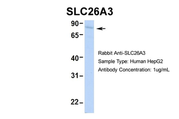 SLC26A3 Rabbit Polyclonal Antibody