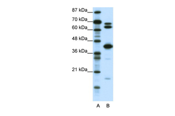 E2F2 Rabbit Polyclonal Antibody