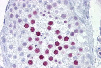PHOX2A Rabbit Polyclonal Antibody