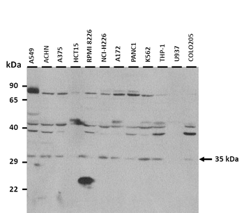 EHF Rabbit Polyclonal Antibody