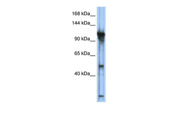 GTF3C2 Rabbit Polyclonal Antibody