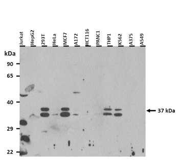 RAX Rabbit Polyclonal Antibody