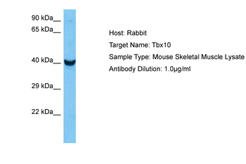 TBX10 Rabbit Polyclonal Antibody