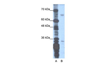 ZNF691 Rabbit Polyclonal Antibody