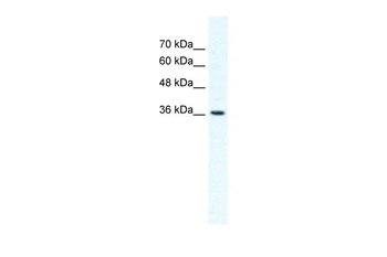 DVL1 Rabbit Polyclonal Antibody
