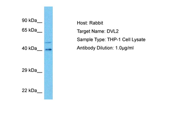 DVL2 Rabbit Polyclonal Antibody