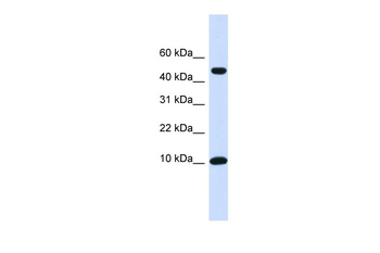 ZNF706 Rabbit Polyclonal Antibody