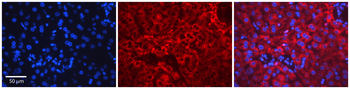 ERCC8 Rabbit Polyclonal Antibody