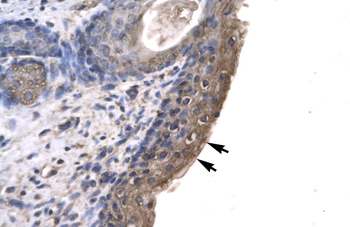 RNF12 Rabbit Polyclonal Antibody
