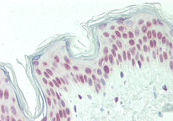 PQBP1 Rabbit Polyclonal Antibody