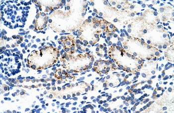 BMP7 Rabbit Polyclonal Antibody